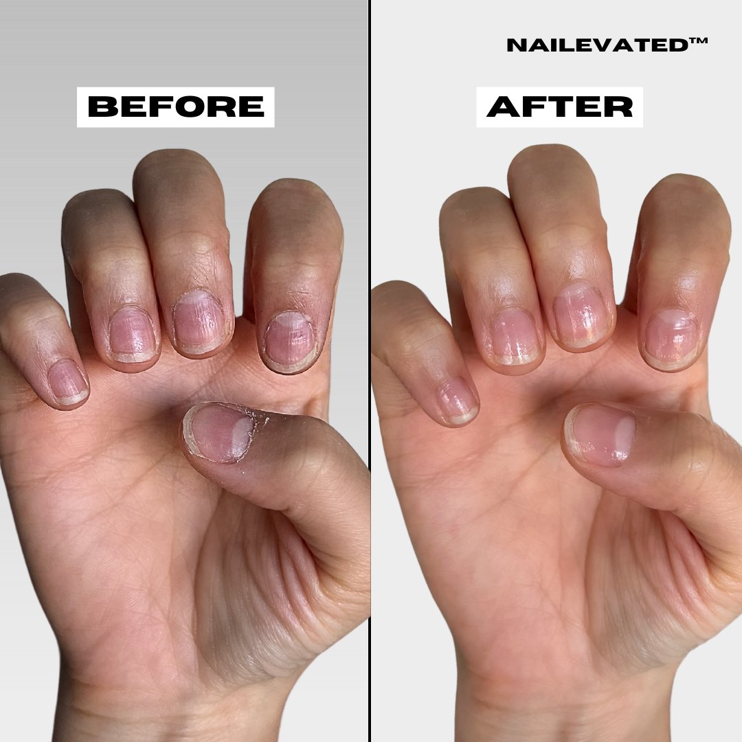 NAIL & CUTICLE OIL - nailevated